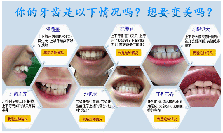 可丽尔博士隐形牙齿正畸真的好吗